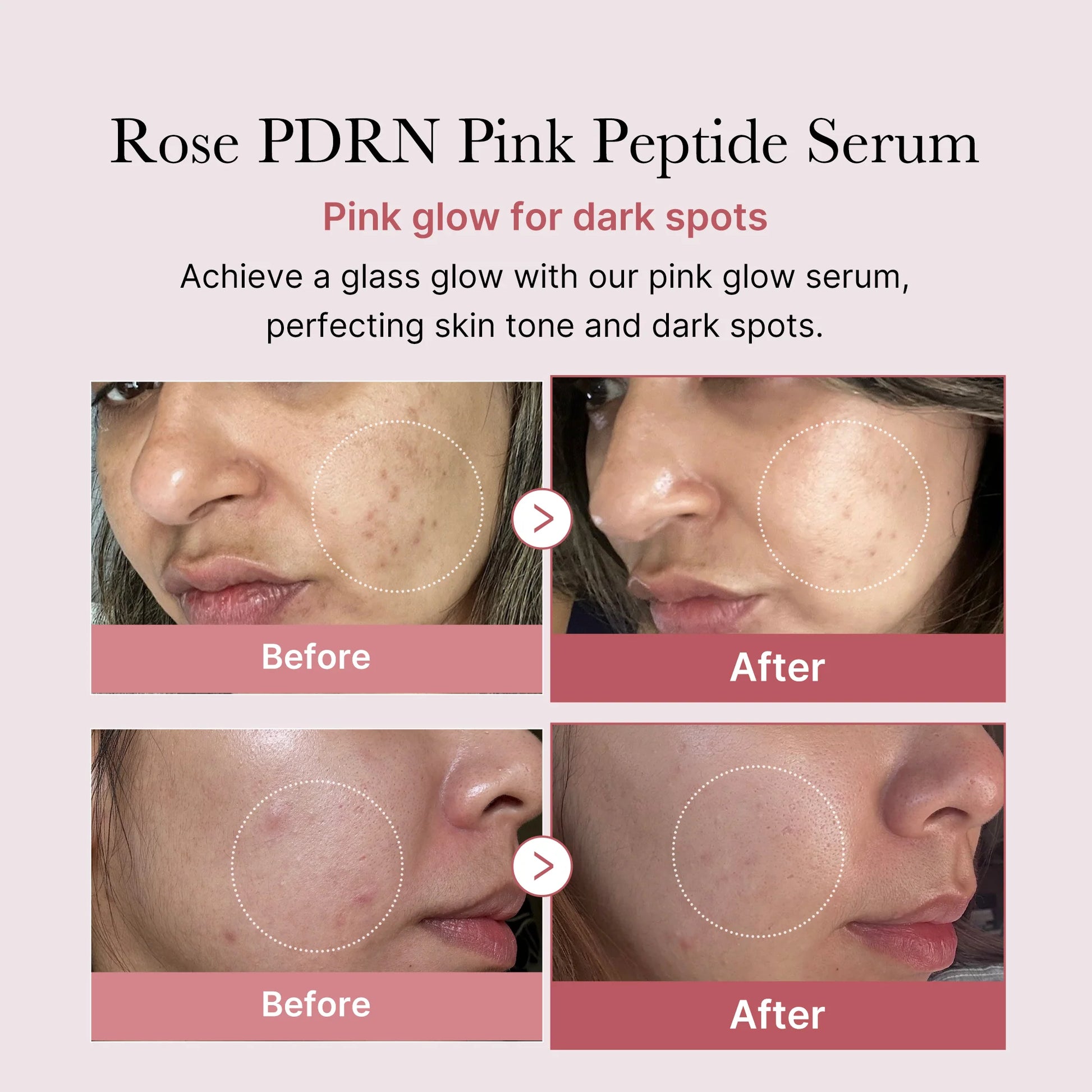 PDRN Pink Peptide Serum